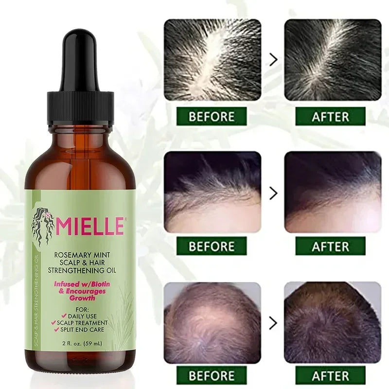 Oil Nourishing Treatment For Split Ends And Dry Mielle Organics Hair