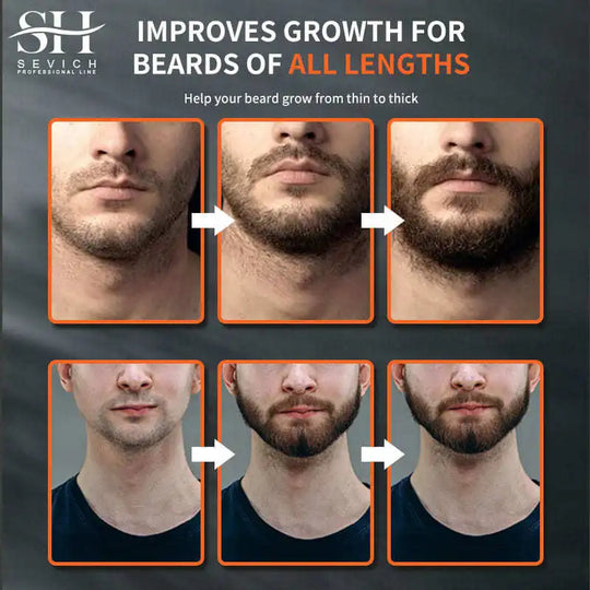 Men Natural Beard Growth Chebe Oil Fast